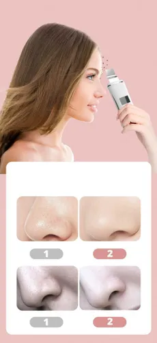 Braders Peeling Kawitacyjny 5w1 Ultrasonic Skin Scrubber