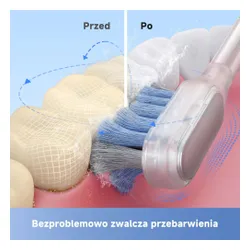 Szczoteczka soniczna DREAME Mova Fresh Pro Czarny