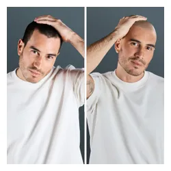 Golarka ROWENTA TN3110 Na mokro i sucho