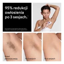 Depilator Braun Skin i·expert PL7431