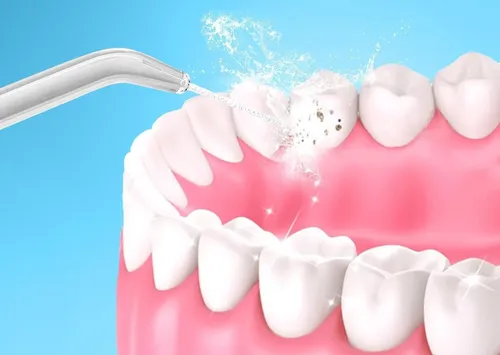 Irygator EXTRALINK L10